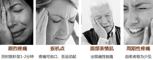 成都三叉神经痛是如何诊断的？