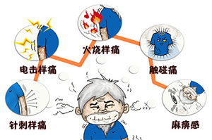 成都三叉神经痛患者会有哪些症状？