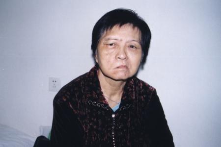 三叉神经痛