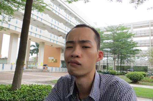 梅杰综合征