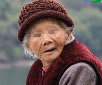 三叉神经痛
